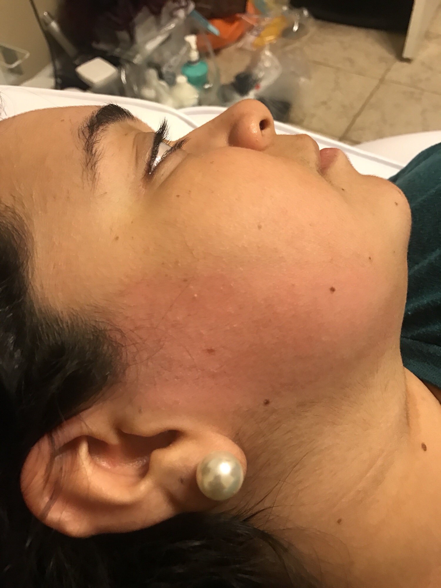 an after image of a woman getting a facial wax